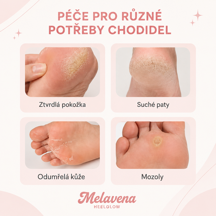 Péče pro různé potřeby chodidel